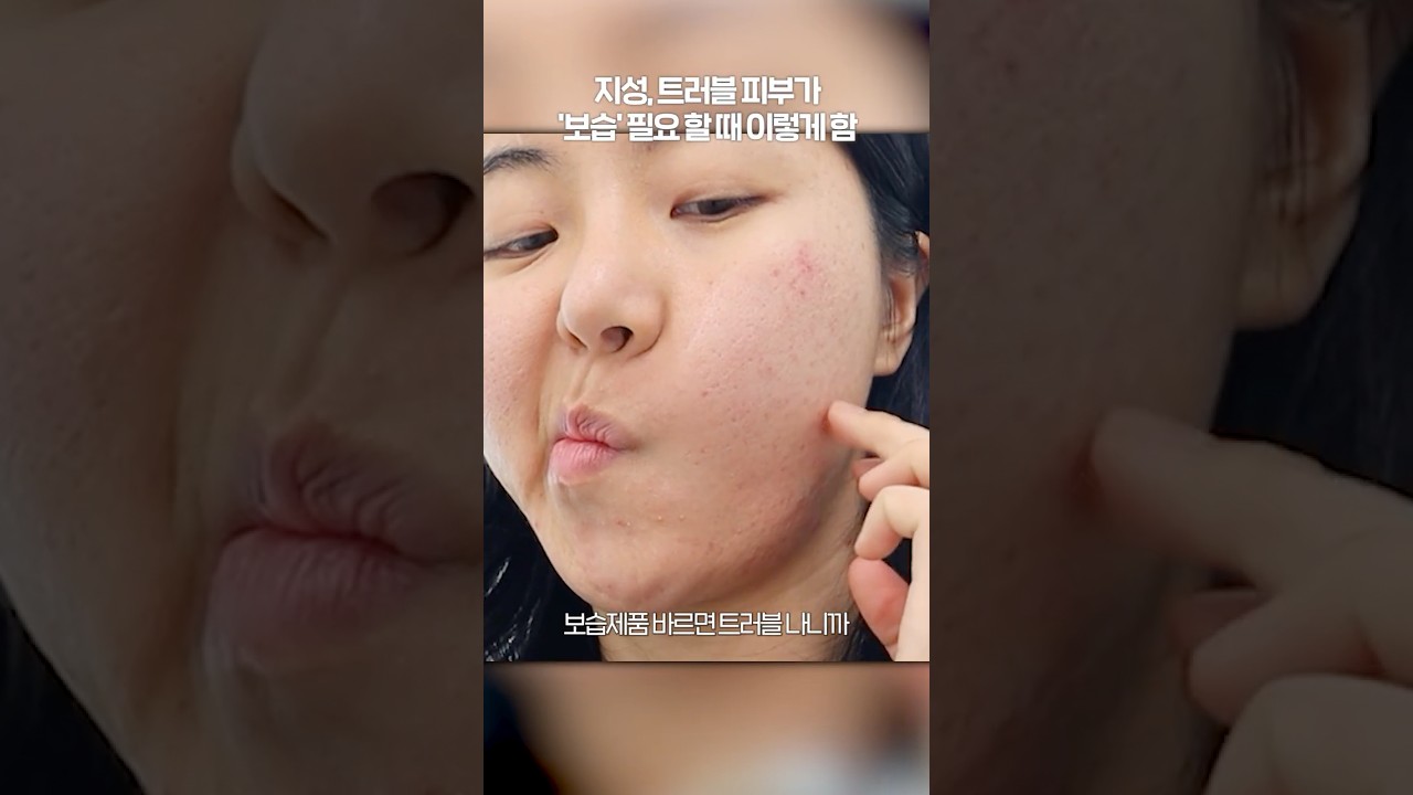지성 여드름 피부는 건조 할 때 이렇게 합니다...
