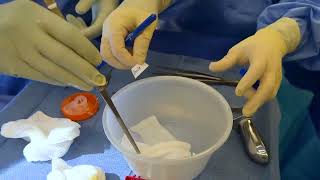 Topical Application Of Formalin For Chronic Radiation Procis