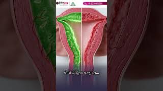 IVF Implantation Failure in Palanpur | Thin Endometrium &amp; Pregnancy Failure | Best IVF Specialist