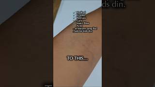 Bai Yao Lang  Skin Ointment