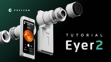Tutorial Eyer2 - Phelcom