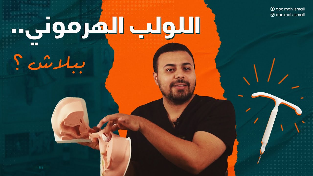 اللولب الهرموني