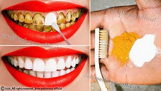 Natural mixtures for yellow teeth whitening at home in 2 minutes without a dentist, a proven method💯