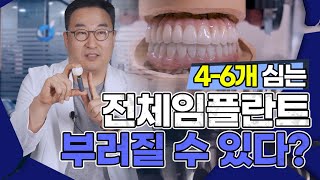 [부산전체임플란트] 임플란트 부러질 수 있다? 신준혁 원장이 알려주는 전체임플란트 이야기 [디지털아트치과]