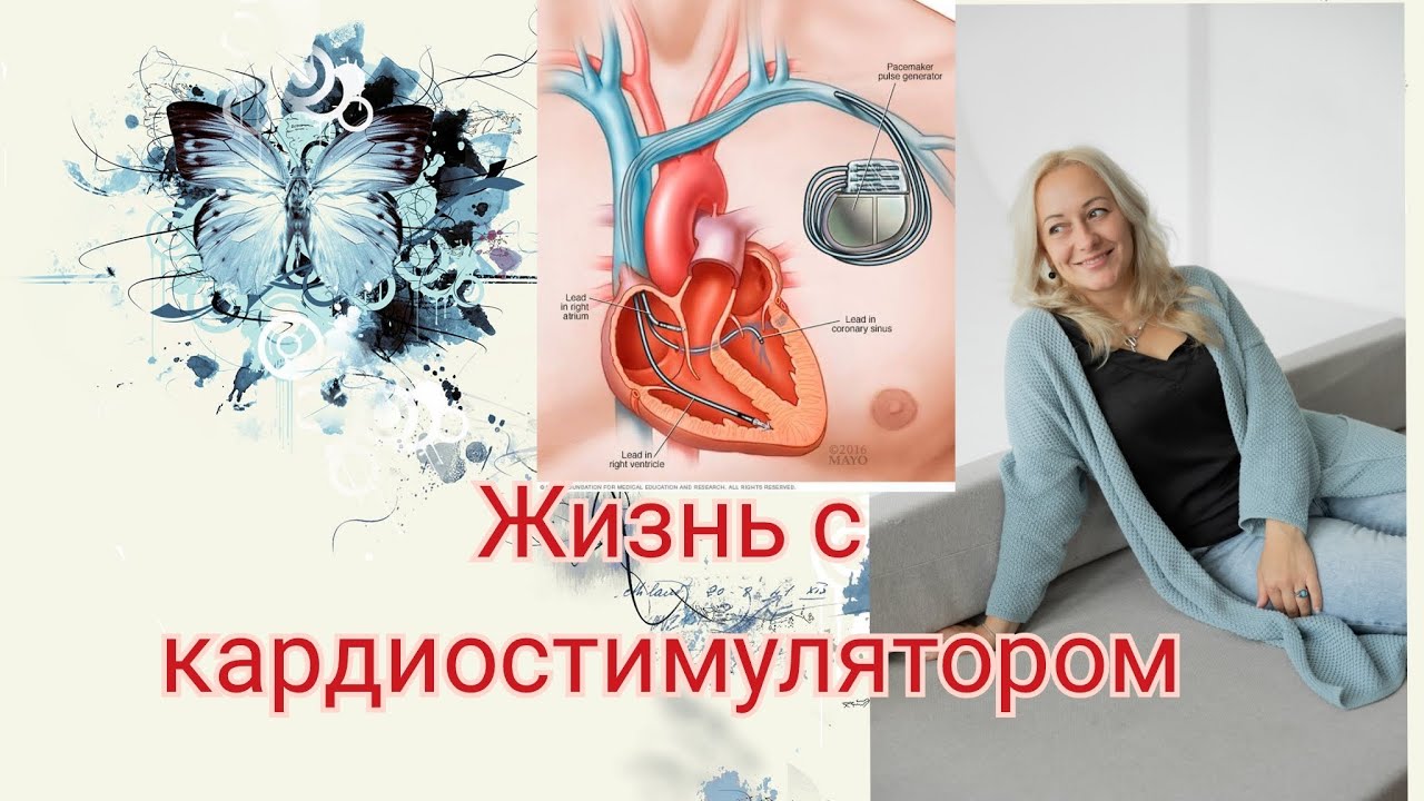 Жизнь с кардиостимулятором - YouTube