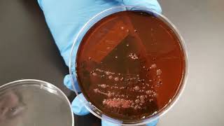 Microbiology of Water: Confirmed Test
