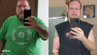 Aaron King - CHI Health Bariatric Surgery Patient