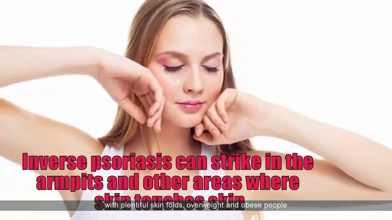 What Do You Know About Inverse Psoriasis? Best Tips To Treat Inverse Psoriasis YouTube