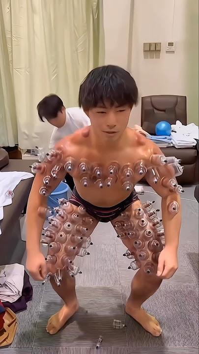 Cupping Therapy