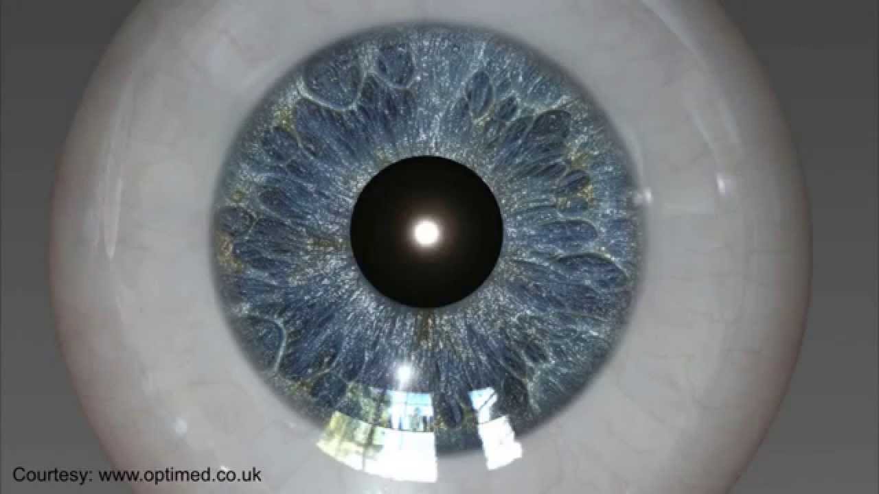 KAMRA Inlay at Maloney Vision Institute Reading Vision Correction