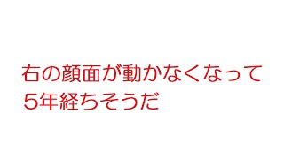 【2ch】右の顔面が動かなくなって5年経ちそうだ