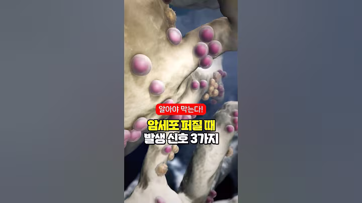 암세포 퍼질 때 나타나는 신호 3가지