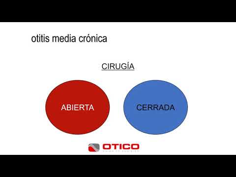 Video: Otitis Crónica