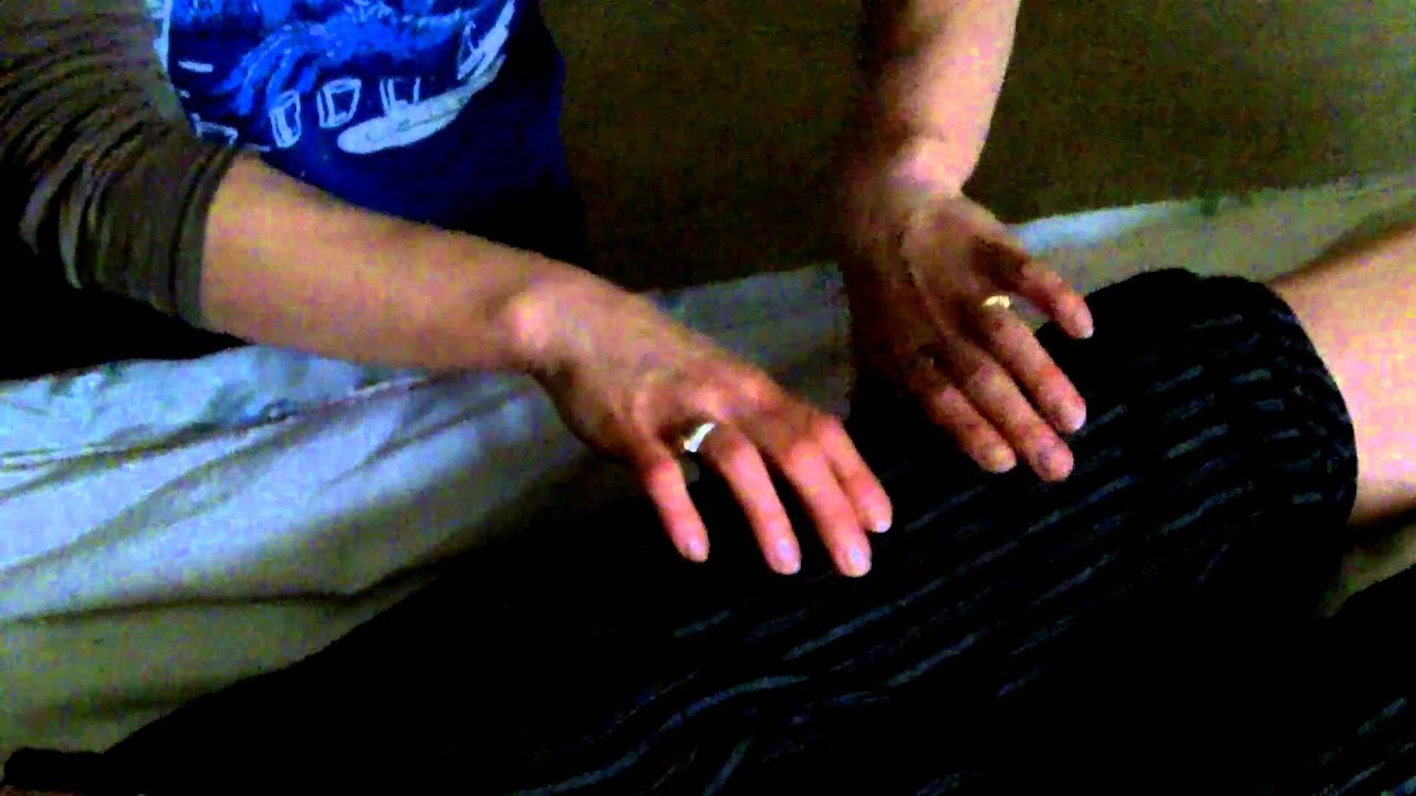 Neuropathy with Muscle Atrophy YouTube