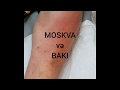 MESLEHETLİ HEKİM TÖVSİYESİ keskin selülit ayaga mismar batmasi sekerli xestede ismail hekim cerrah