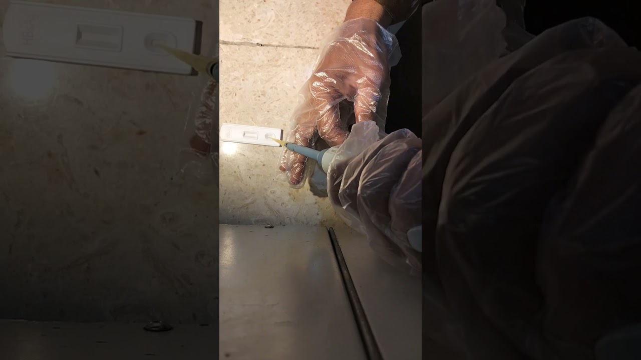 HBSAG test perform Full Details 