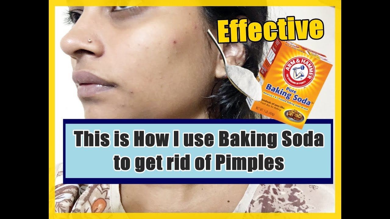 Baking help pimples soda does Dermatologist Tells