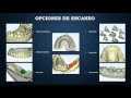 Sistema CAD/CAM Completo con MDC Dental