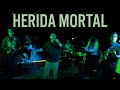 Deerland  herida mortal  kalista live session