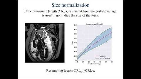 MICCAI 2015: Automated Localization of Fetal Organs