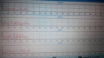 Sensor arus sct arduino delphi grafik / chart taufik 085743320570