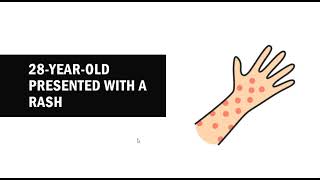 T cell activation and antigen presentation, Step 1 Prep.