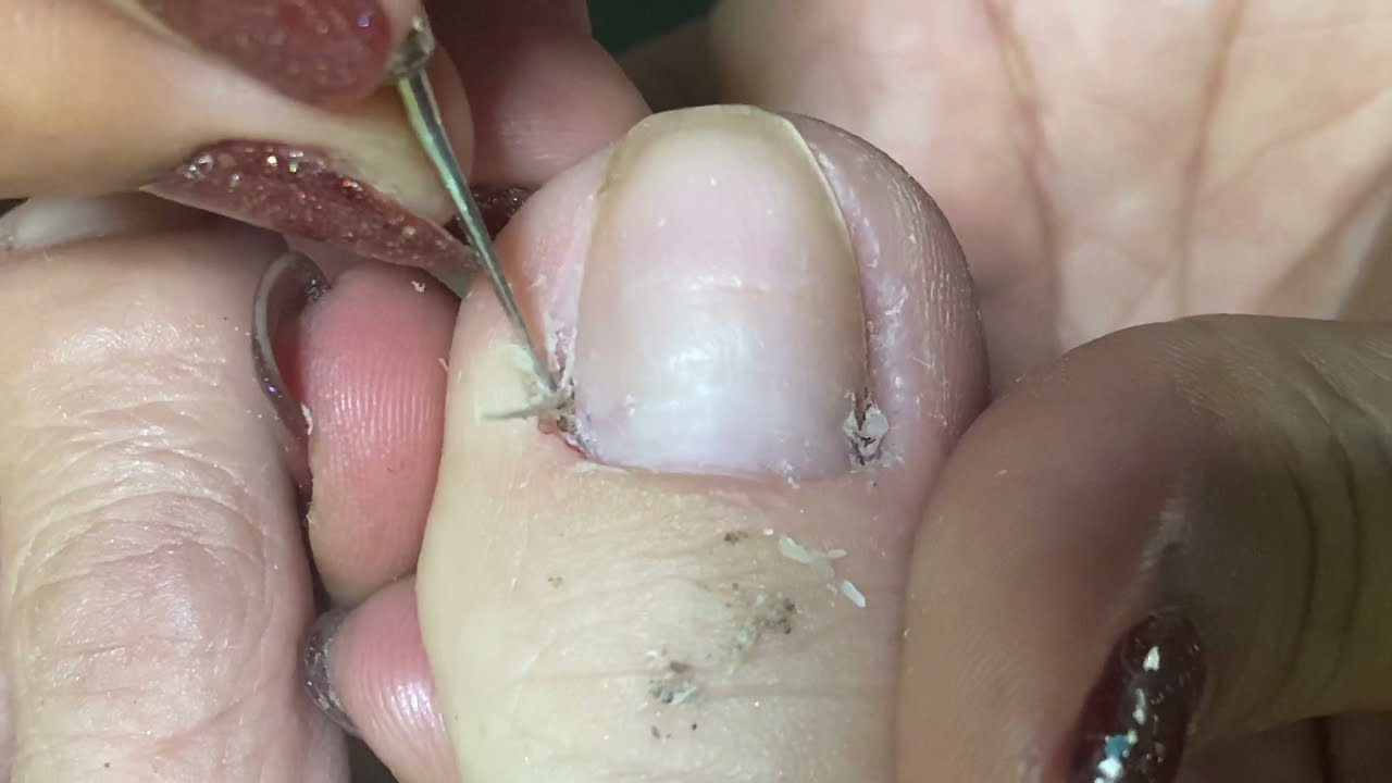 How to Repair Nails easy 340 YouTube