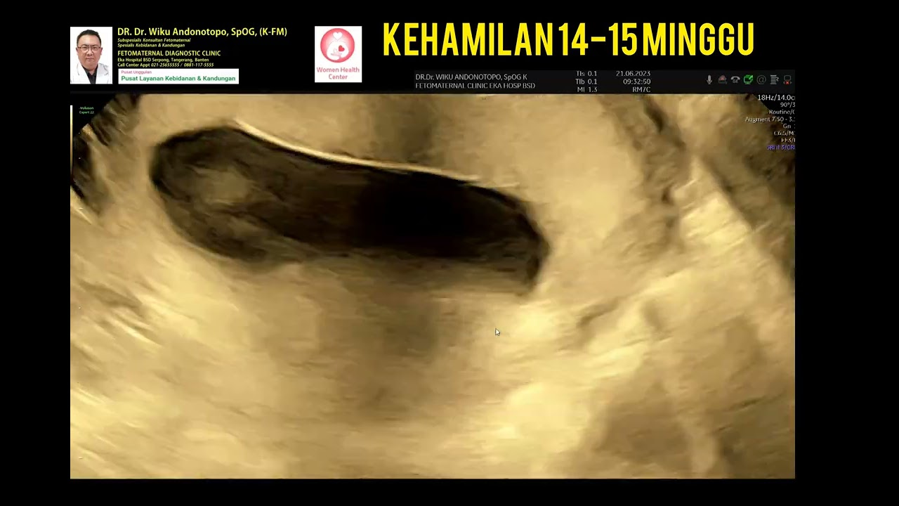 Kehamilan 14-15 minggu