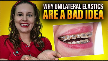 Why Unilateral Elastics (Class 2 Class 3) are a BAD Idea in Braces or Invisalign