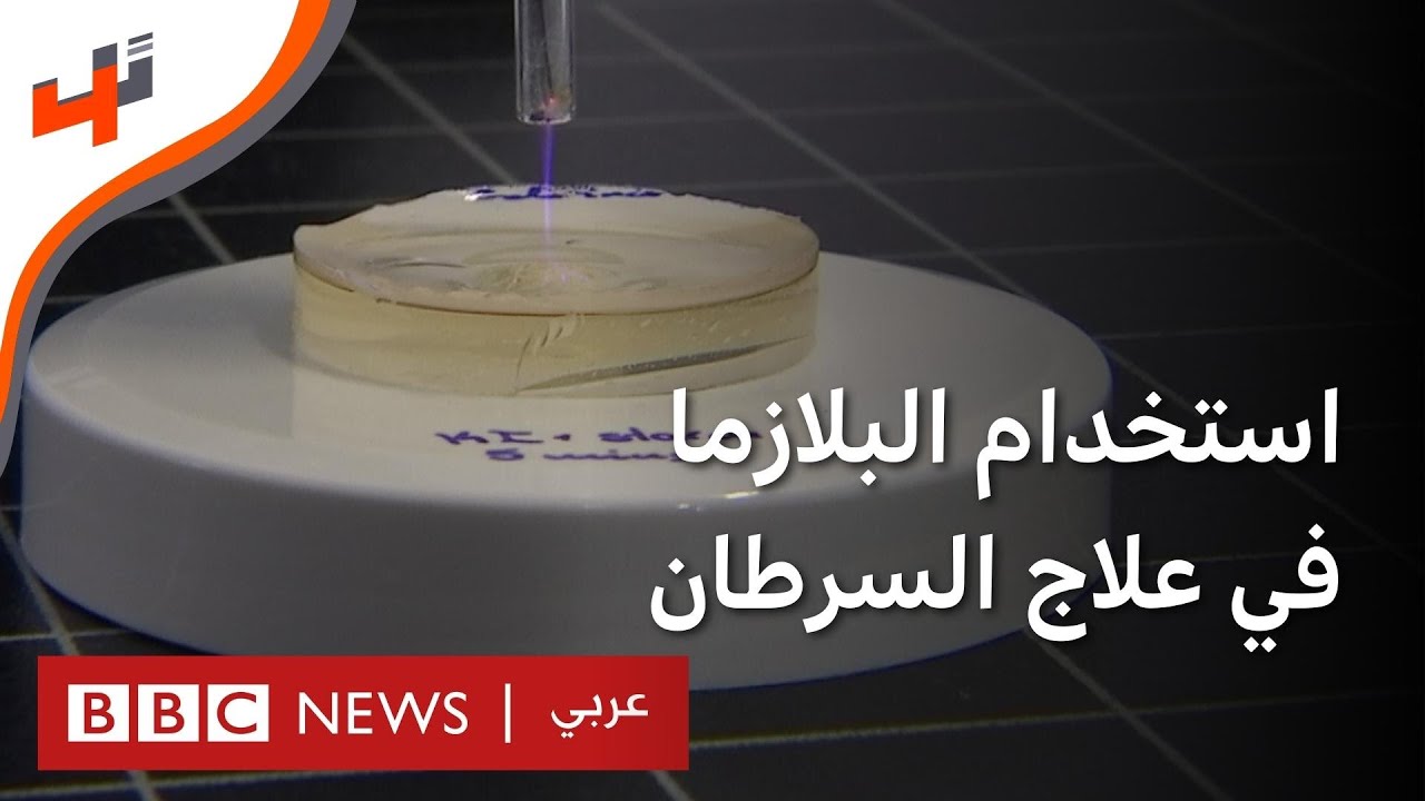 كيف تستخدم البلازما في علاج سرطان نقي العظم؟