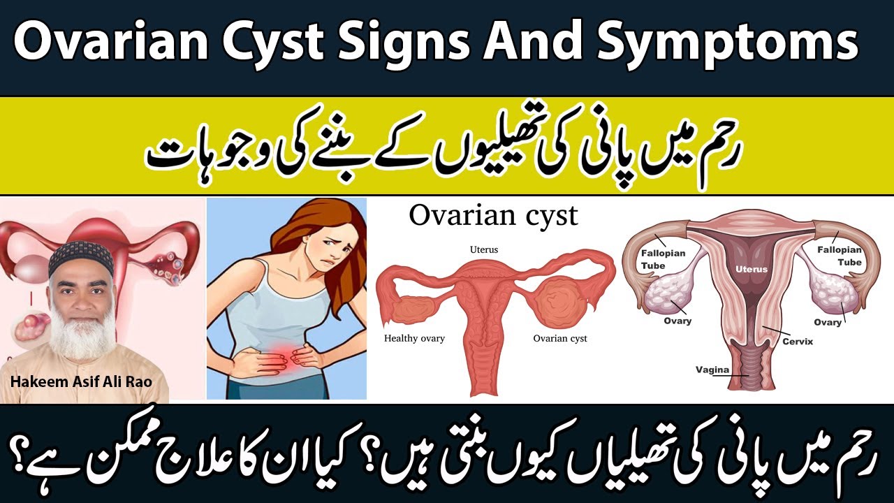  Ovarian Cyst Signs And Symptoms Reham Mian Pani Ki Theliyan Ban