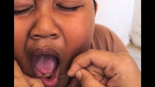 Cabut GiGi alif si anak nakal ... hahaha