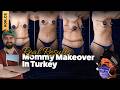 Mommy Makeover | Everything You Need to Know — Dr. Cengizhan Ekizceli