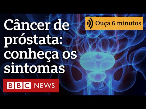 Vídeo: 4 maneiras de reconhecer os sintomas do câncer de próstata