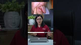 Tobacco Cancer symptoms | smoking oral cancer symptoms mouth cancer |Dr Asmita Best Dentist in Surat Tobacco Cancer symptoms | smoking oral cancer symptoms mouth cancer |Dr Asmita Best Dentist in Surat