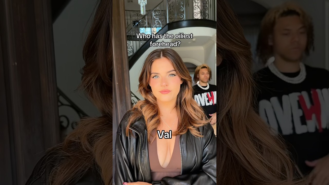 Who has the oiliest forehead?