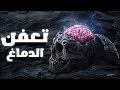 كيف يدمر تعفن الدماغ حياتك 