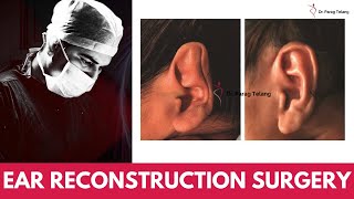 How Ear Reconstruction Surgery Cure Ear Deformities Designer Bodyz Microtia In Mumbai