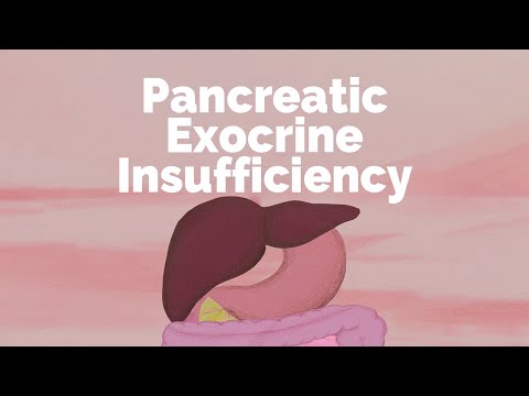 Pancreatic Exocrine Insufficiency | Gastrointestinal Society