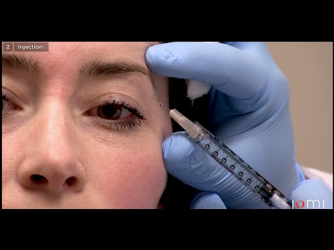 Botox Injection (Links to Full Procedure)