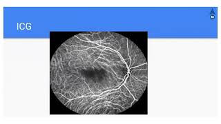 Indocyanine green angiography an explanation by Ms. Priyanka