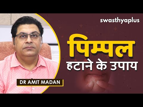 पिम्पल से कैसे पाएं छुटकारा? | How to Remove Pimples in Hindi | Dr Amit Madan