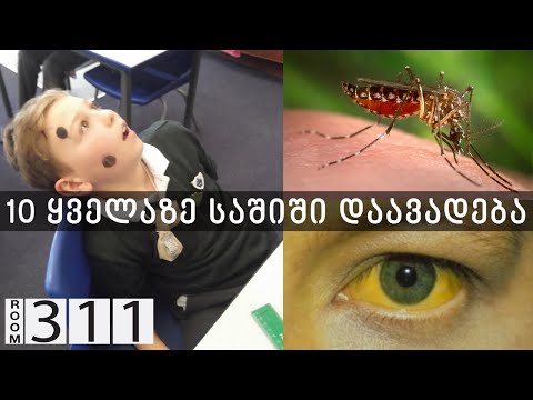 10 ყველაზე საშიში დაავადება ისტორიაში