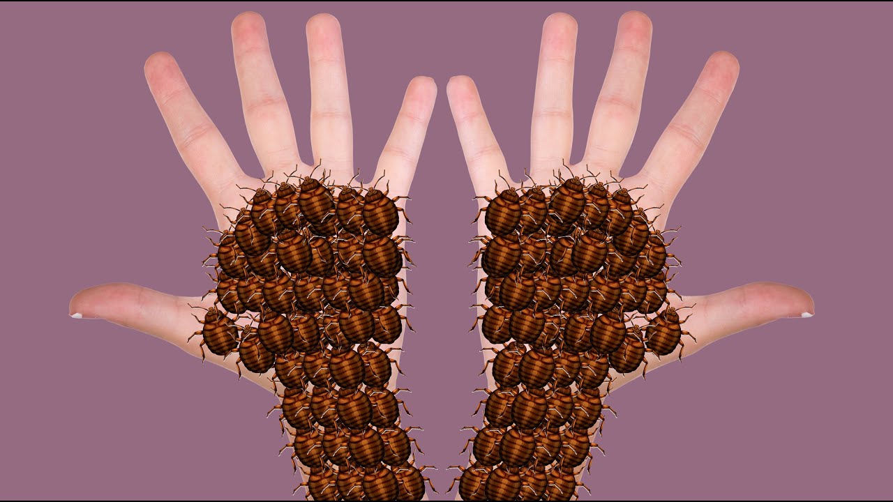 ASMR Remove dog tick , Maggot , pimple from infected hands ASMR