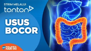 [FULL] Malaysia Hari Ini (2026) | Tue, 10 Feb - Usus Bocor | Tonton