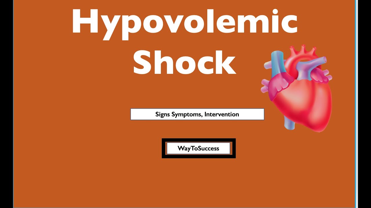 Hypovolemic Shock Nursing made easy video. YouTube