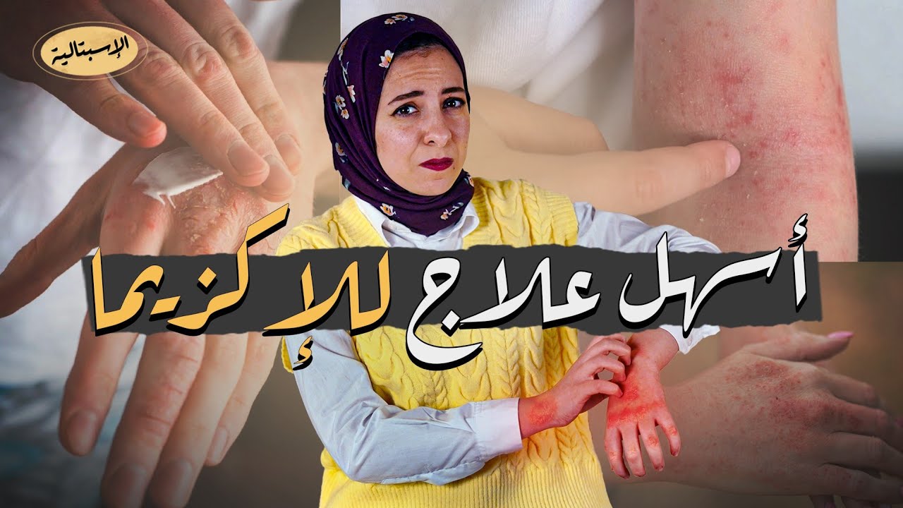 معاناة الإكزيما (التهاب الجلد التأتبي) | إيه العلاج ؟ | الاسبتالية