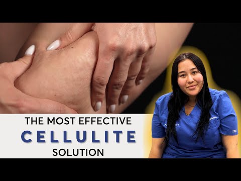 How to Get Rid Of Cellulite | Tighten Bum & Tights