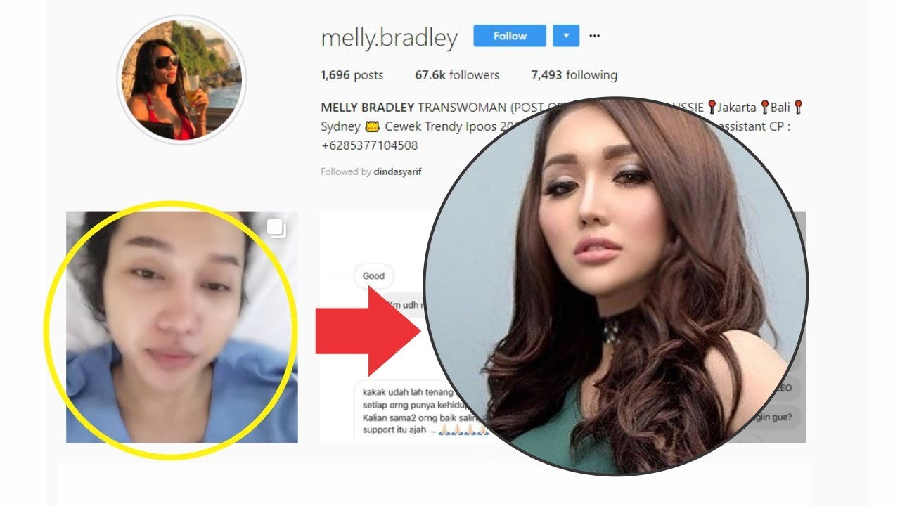 Unggah Video Mirip Lucinta Luna Operasi Kelamin Tanpa Sensor