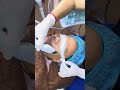#detoxfacemassage #pimple #massage